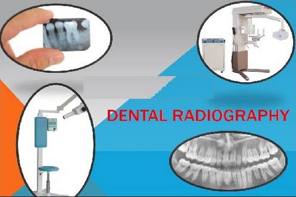 دانلود پاورپوینت حفاظت پرتویی در رادیوگرافی دهان و دندان 2021
