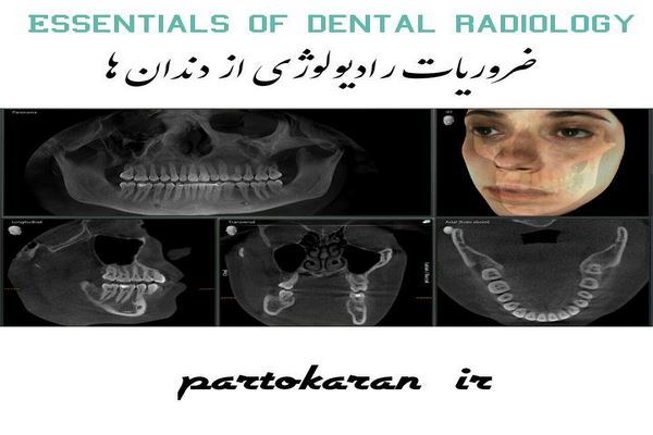 دانلود ضروریات رادیولوژی از دندان ها 2021
