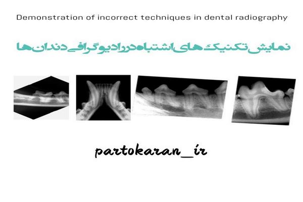 دانلود نمایش تکنیک های اشتباه در رادیوگرافی دندان ها 2021