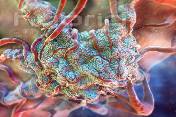 پاورپوینت بررسی سرطان