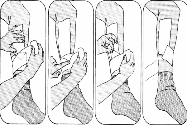 پاورپوینت بررسی زخم ها (پانسمان و بانداژ)