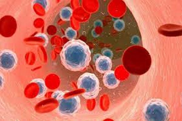 دانلود پاورپوینت سرطان خون 2021