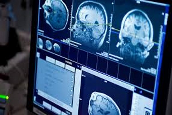 دانلود پاورپوینت ارزیابی خون ریزی های مغزی در MRI 2021